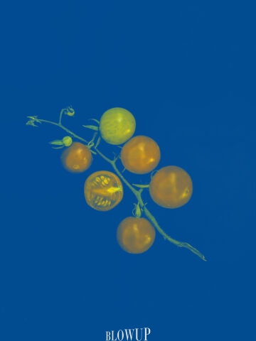 x-ray