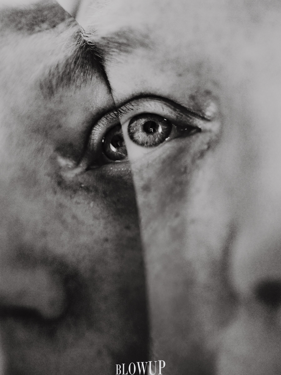 Eye