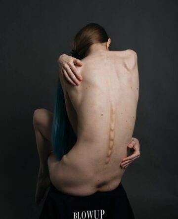 Back